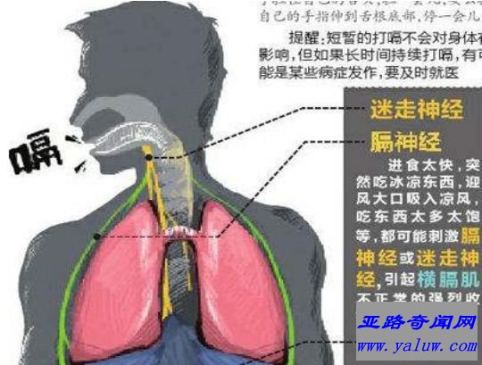 打嗝时间最长的人，查尔斯.奥斯本每天打嗝24000次(长达68年)