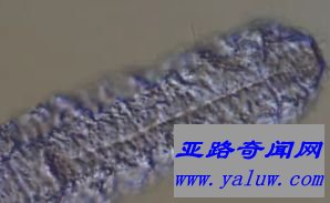 世界上最小的生物，腹毛动物，体长3毫米